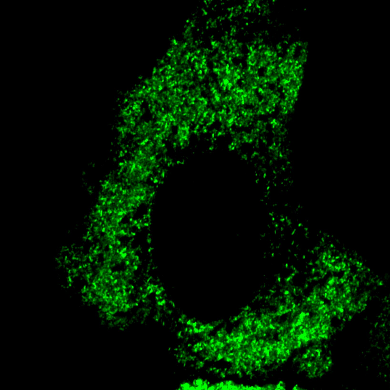 The FXR1 network acts as signaling scaffold for actomyosin remodeling